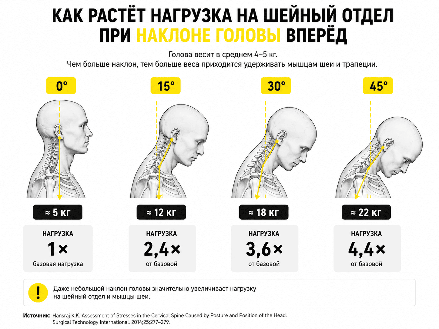 Как растёт нагрузка на шейный отдел при наклоне головы вперёд